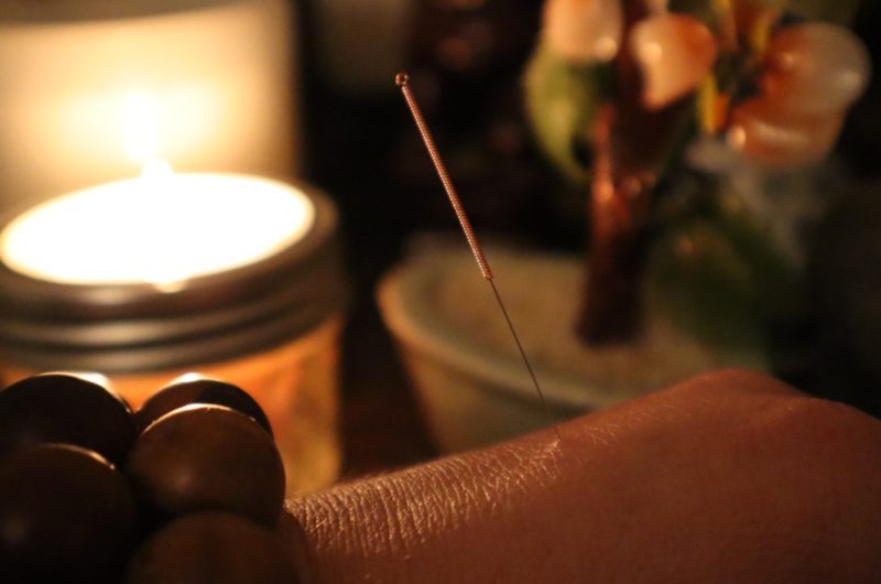 Acupuncture and candles